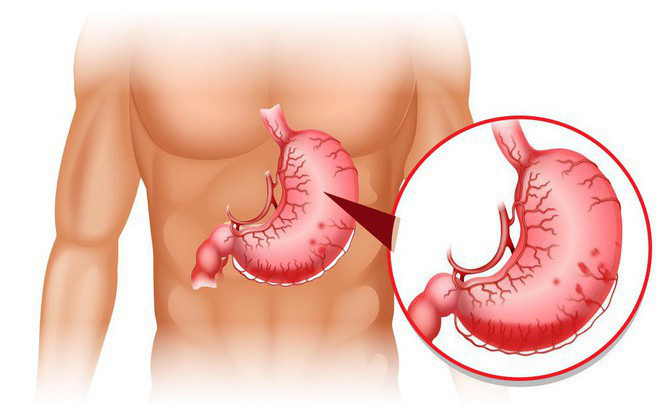 Top 15 công dụng của hạt Óc Chó có lợi cho sức khỏe 22 Top 15 công dụng của hạt Óc Chó có lợi cho sức khỏe 15