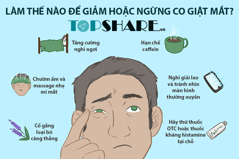 Giải mã Giật mắt trái hay Nháy mắt trái ở Nam Nữ theo quan niệm Khoa học 14 Cách khắc phục tình trạng Giật mắt trái giật hay Nháy mắt trái ở Nam Nữ theo Tây Y