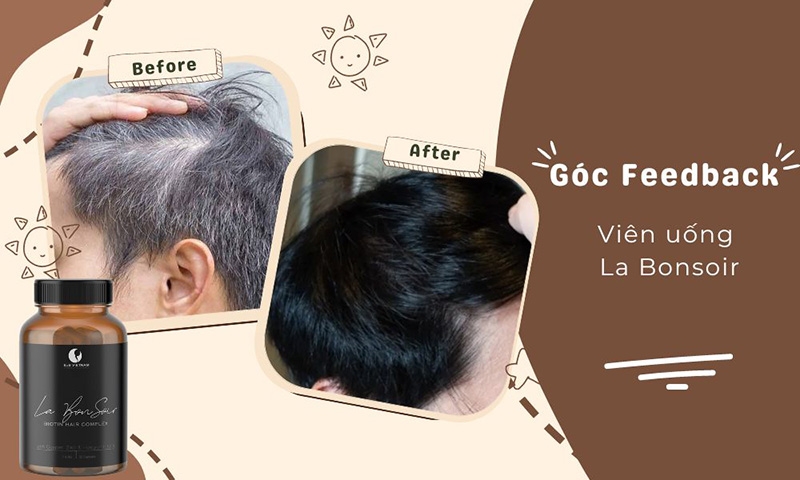 Review chi tiết viên uống trẻ hóa tóc La Bonsoir, liệu có hiệu quả như lời đồn? 9 Cảm nhận của người dùng sau 3 tháng sử dụng viên uống trẻ hóa tóc La Bonsoir