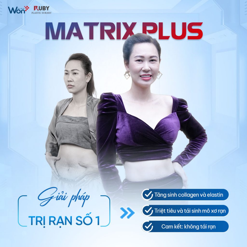 Trị rạn da bằng công nghệ Matrix Plus tại Won Clinic có tốt như quảng cáo? 5 Trị rạn da bằng công nghệ Matrix Plus tại Won Clinic có tốt như quảng cáo? 3