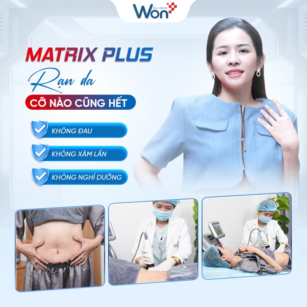 Trị rạn da bằng công nghệ Matrix Plus tại Won Clinic có tốt như quảng cáo? 8 Trị rạn da bằng công nghệ Matrix Plus tại Won Clinic có tốt như quảng cáo? 4