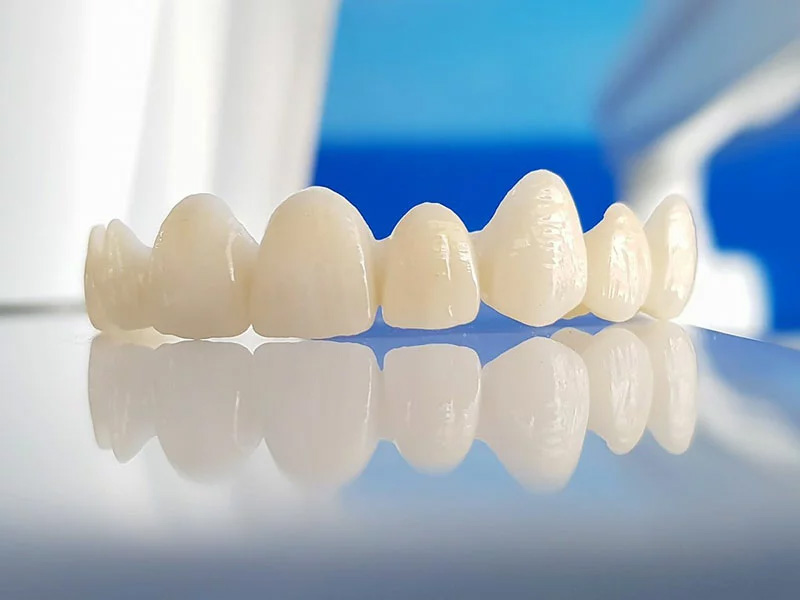 Có nên bọc răng toàn sứ giá rẻ không? Bọc răng sứ ở đâu uy tín? 5 Có nên bọc răng toàn sứ giá rẻ không? Bọc răng sứ ở đâu uy tín? 5