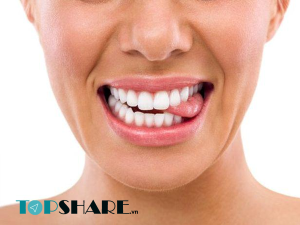 Cắn lưỡi có gây chết người không? 4 Cắn lưỡi có gây chết người không? 2