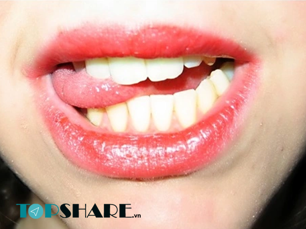 Cắn lưỡi có gây chết người không? 3 Cắn lưỡi có gây chết người không?